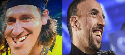 The 10 Least "Hot" Football Players (Ugly!)