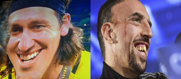 The 10 Least "Hot" Football Players (Ugly!)
